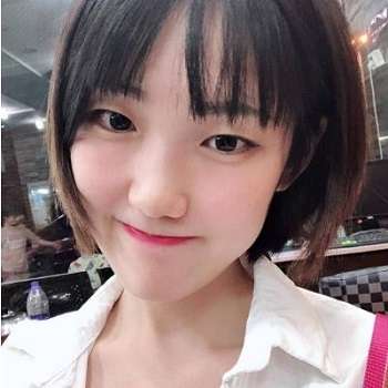 王太玲医生双眼皮案例，清新美观的7mm双眼皮塑造