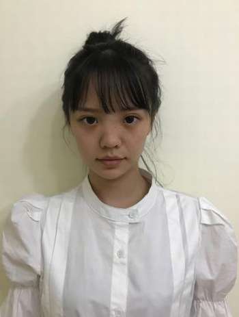 任天平医生做的鼻子案例，专业技术打造精致的鼻子