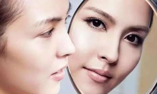 面部 双眼皮 眼睛 吸脂 (8).jpg