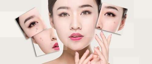 面部 眼睛 吸脂 (10).jpg