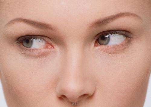 光乳化去眼袋 (2).jpg